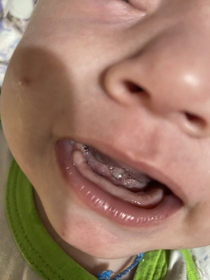 Зубы