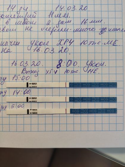 Выход укола ХГЧ 10