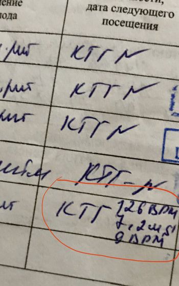 Кто разбирается в КТГ?