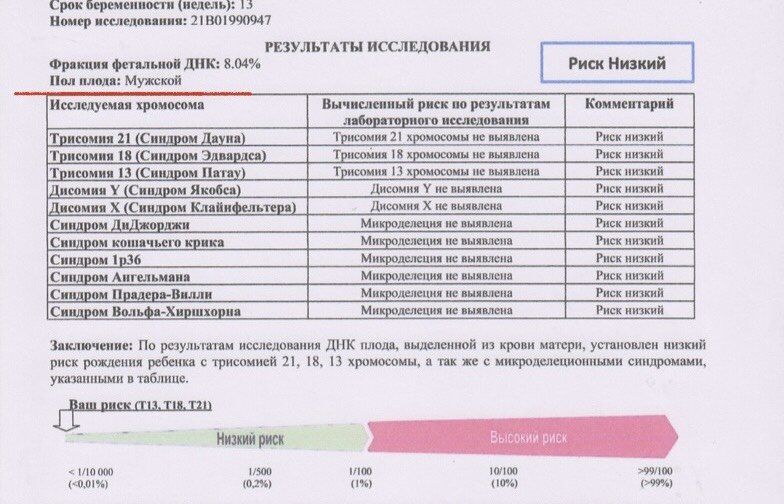 НИПС