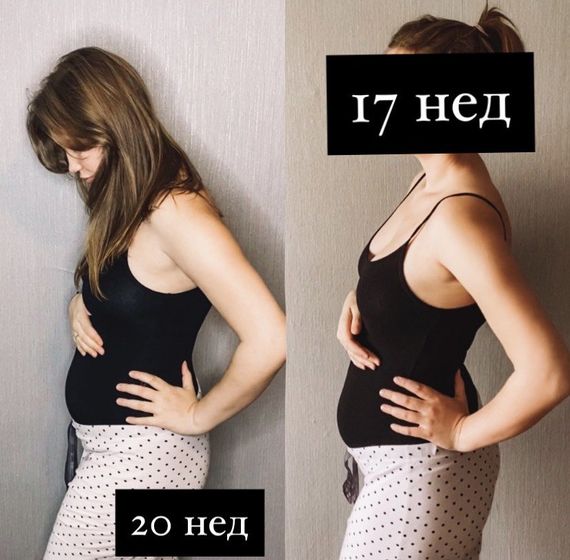 20 недель полёт нормальный,