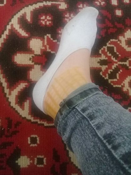 В этом месте опухает