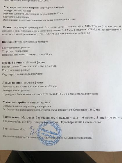 Узи