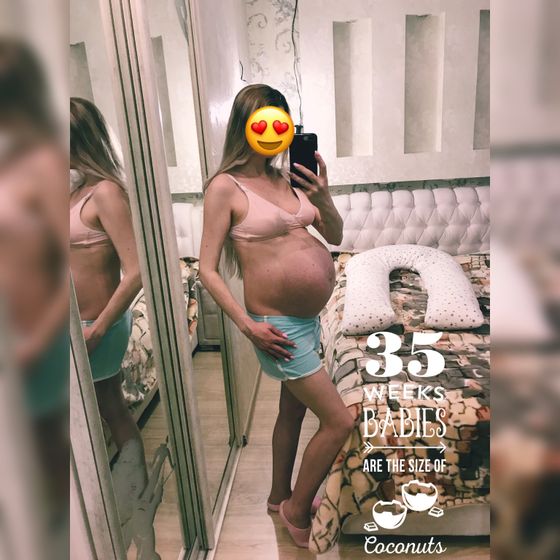 ❤️❤️❤️34 недельки и 1 день❤️❤️?