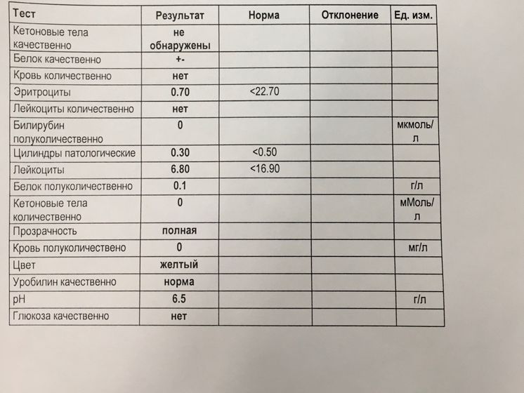 Анализ мочи, кто разбирается?