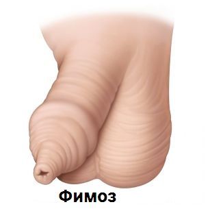 Мамы мальчиков вопрос к вам
