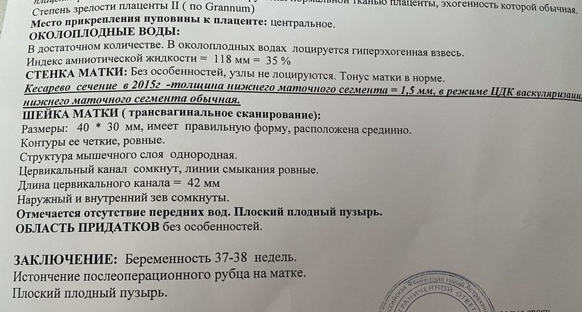 ПКС. Шов=1.5 мм