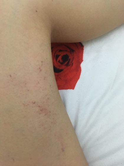 Депиляция воском