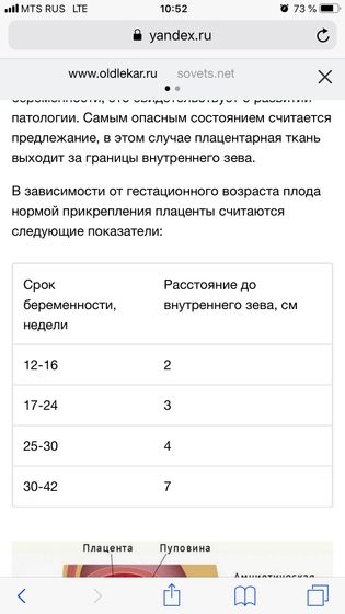 Узи в 27 недель