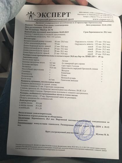 Девочки ,у кого какие