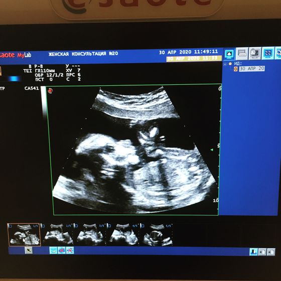 21 неделя🤰🏻