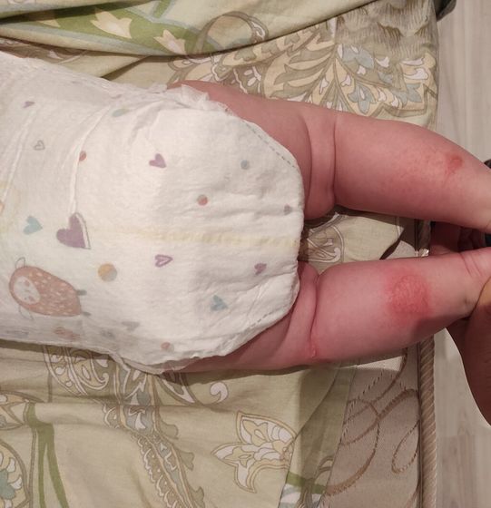Перед новым годом вылезло