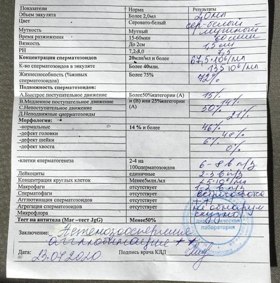 Спермограмма
