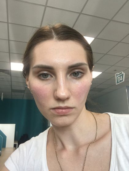 РОЗАЦЕА !!!! 🆘🆘🆘🆘🆘🆘🆘🆘🆘🆘🆘Девочки подскажите у кого может было ?
