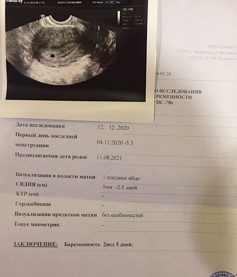 Сходила на узи