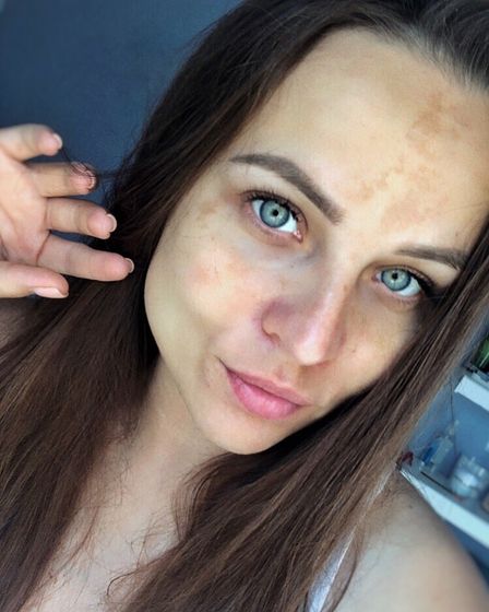Надеюсь, что быстро пройдет?