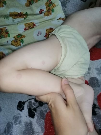 Что за пятна?