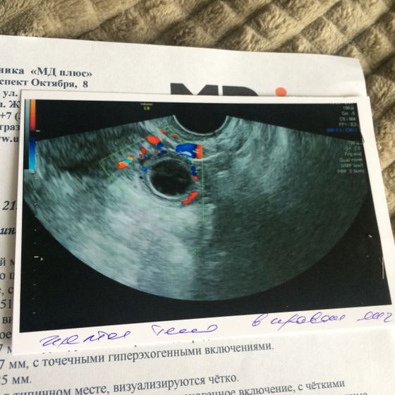 Вот заключение, что скажете?