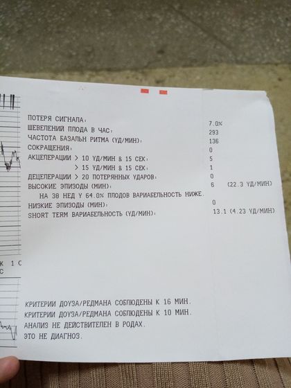 Была на ктг нормально