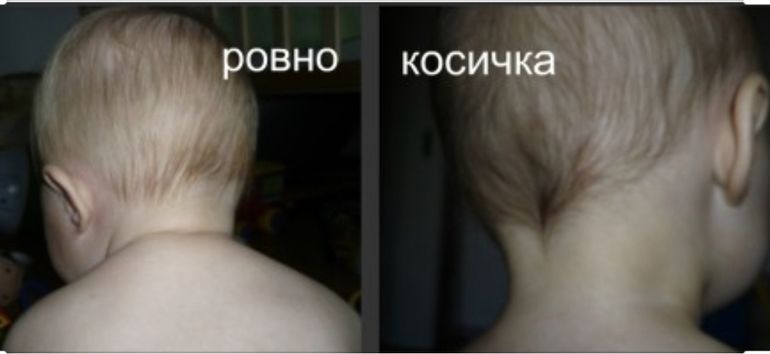 Пол ребенка