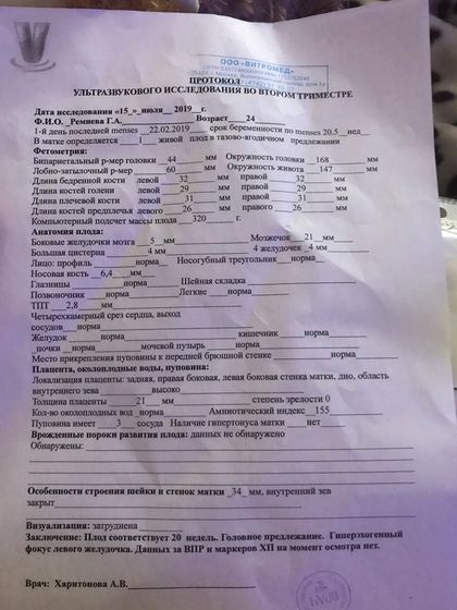 Сделала Узи ?❤️