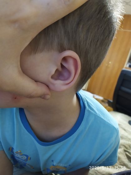 Распухло ухо