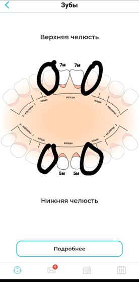 Доброй ночи) какие зубы