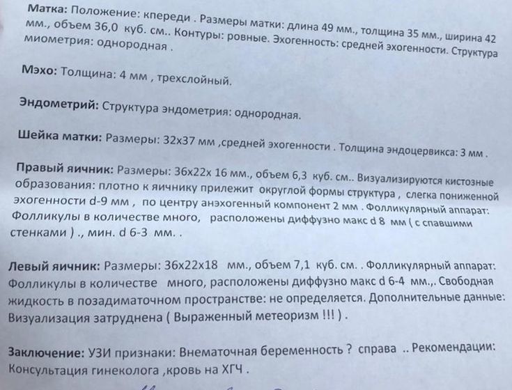 Девы такая история у подруги!Тесты полосатые, хгч растет, узи вот такое!