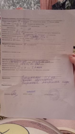 Девочки у кого небольшое