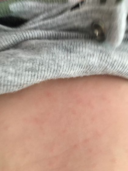 Девочки подскажите это потница