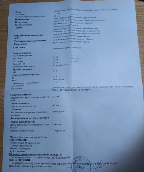 2 скрининг. У нас будет сын!