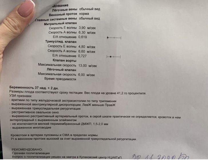 Девочки, хотят проводить К/С, на узи услышали лишний удар , в пуповине :( поставили аритмию