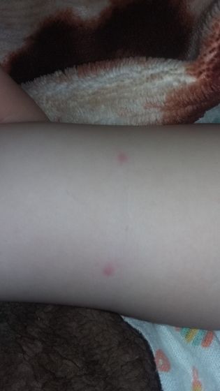 Девочки подскажите что это