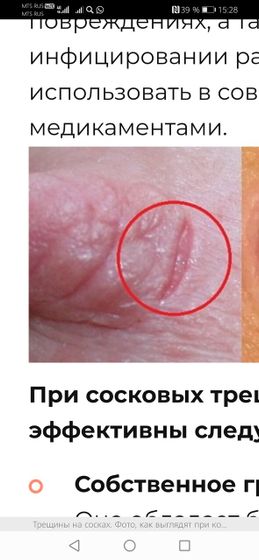 Как вылечить трещину под