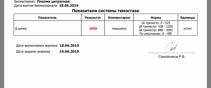 Д димер в 18.06.19