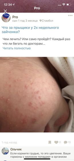 Вот цветение в 2 недели после родов и то что стало сейча поры расширены