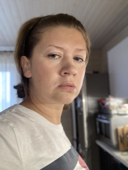 Женщины 40+. Плазмолифтинг