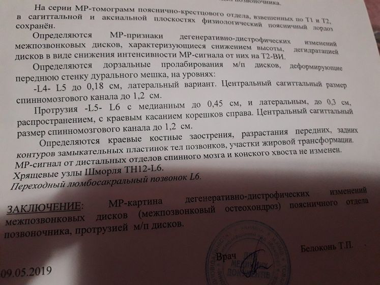 Протрузия пояснично крестцового отдела