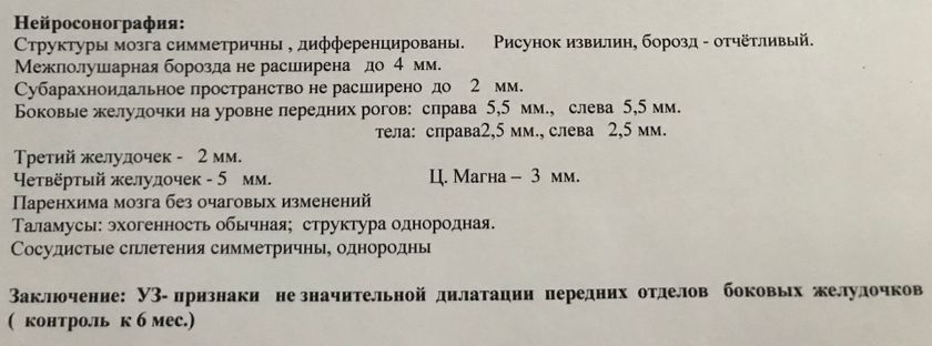 Нсг -незначительная дилатация передних