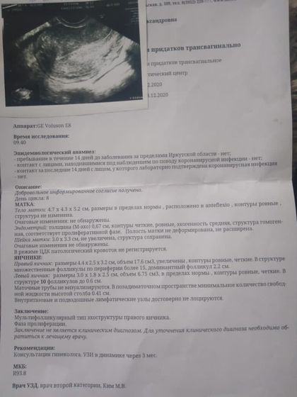 Овуляция