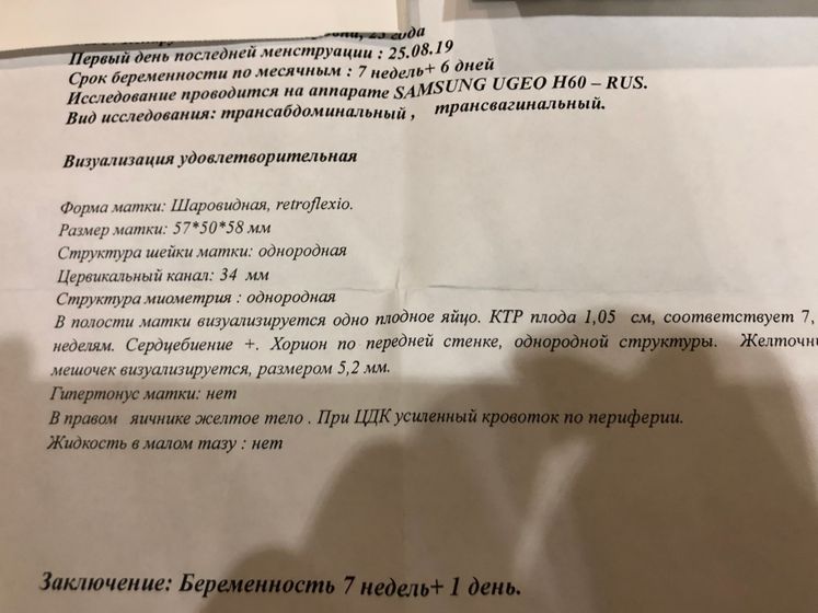 Сходила на узи! Увидели плод в 7 недель!