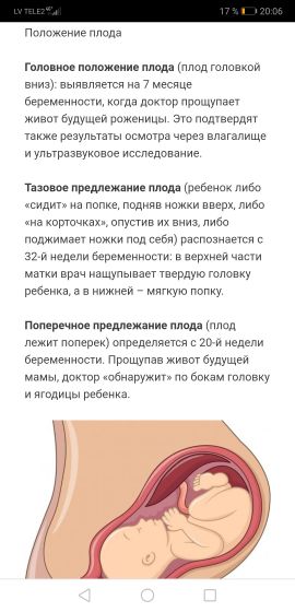 КОГДА РЕБЕНОК ПЕРЕВОРАЧИВАЕТСЯ ГОЛОВОЙ ВНИЗ?