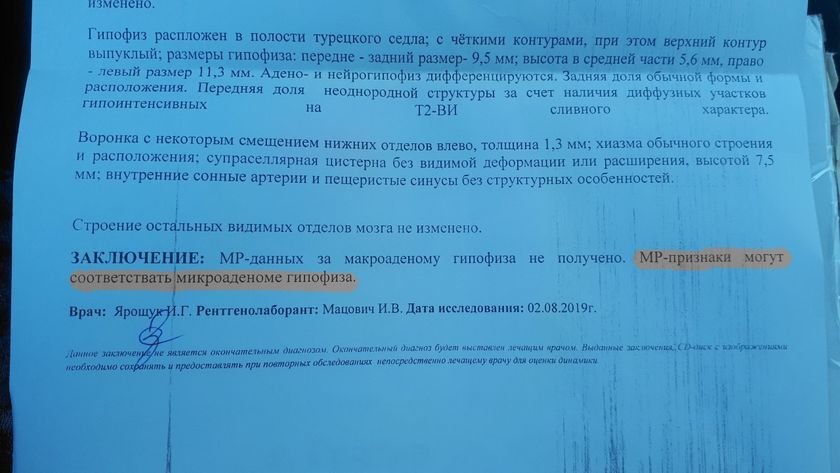Есть тут неврологи?? Зайдите пожалуйста 🙏
