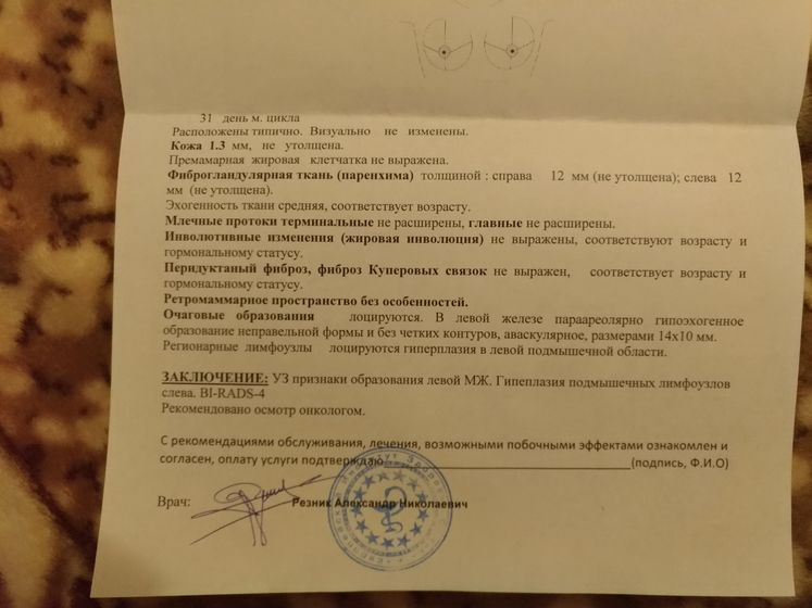 УЗИ молочных желез