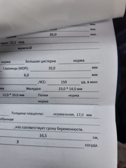 УЗИ тахикардия