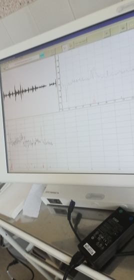 Гость в кабинете ктг