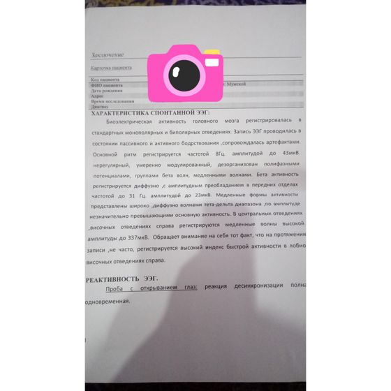 Кто расшифрует ЭЭГ?