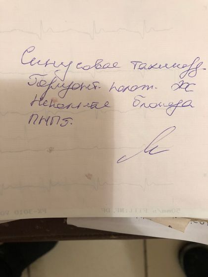 Экг может кто соображает?Что