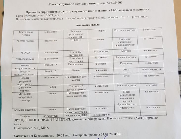 Амниоцентез