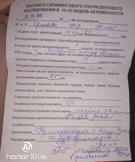 Узи, вроде размеры маленькие,
